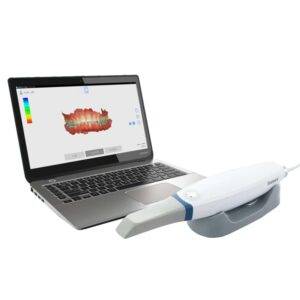 Intraoral Scanner