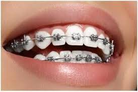 Metal