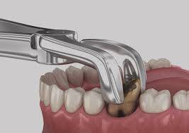 Oral Surgery