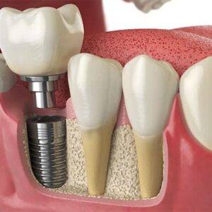 Prosthodontics