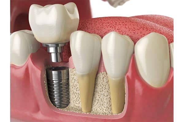 Prosthodontics